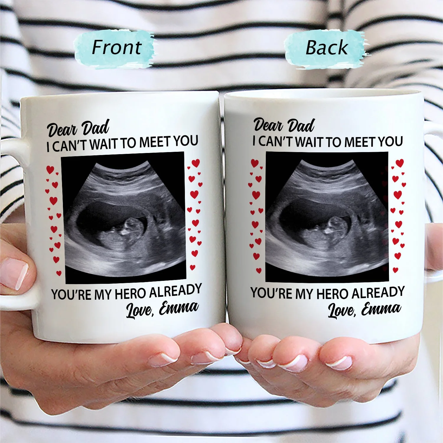 Custom Photo Baby Bump Can't Wait To Meet You - Pregnancy Gift - Personalized Mug - Image 2