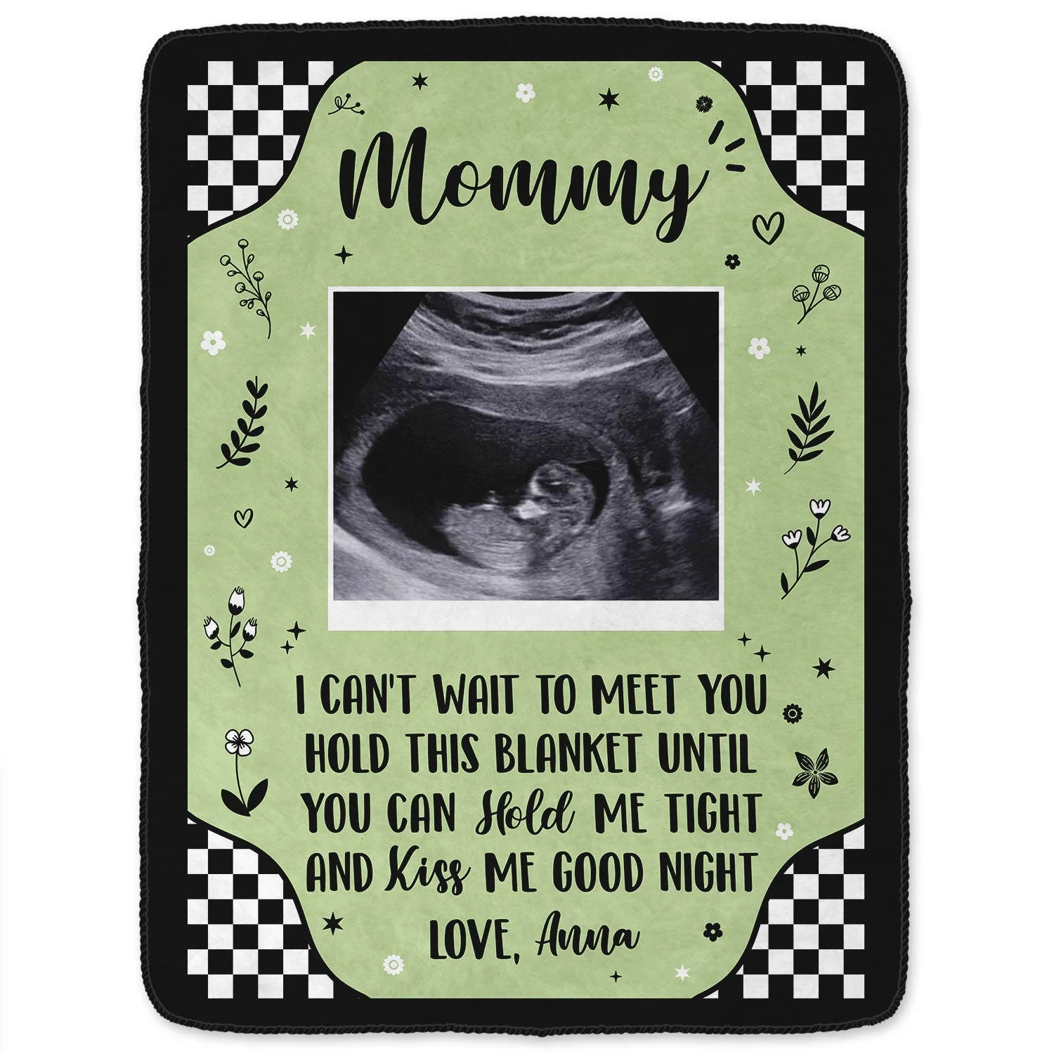 Custom Photo Baby Ultrasound Until You Can Hold Me - Gift For Mother & Father - Personalized Fleece Blanket, Sherpa Blanket - Image 2